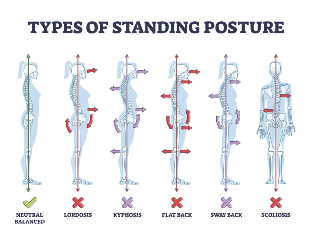 Posture Problems that can cause back and neck pain