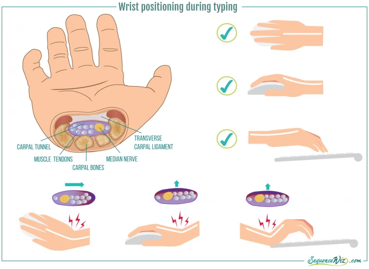 The Top Reason for Wrist Pain (and 5 Other Common Causes) - YogaUOnline