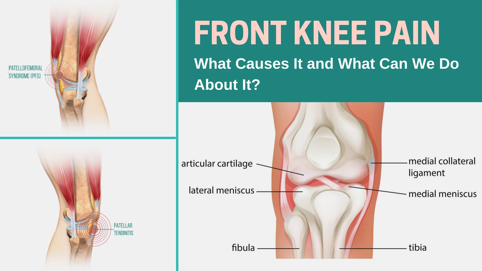 Knee Pain in Yoga: The Yoga Mistakes that Causes Knee Pain