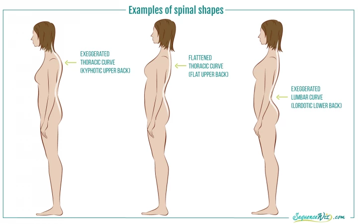 Illustration of posture types: exaggerated thoracic curve (kyphotic upper back), flattened thoracic curve (flat upper back), and exaggerated lumbar curve (lordotic lower back), useful for determining appropriate spine lengthening exercises