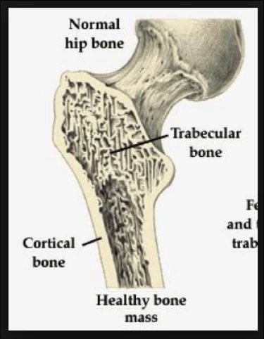 Yoga for osteoporosis 