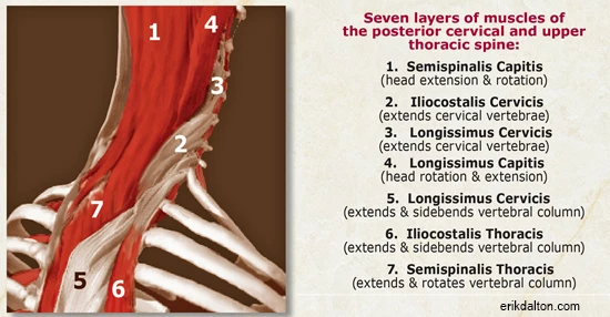 Yoga Anatomy: Different Types of Forward Head Posture and How to