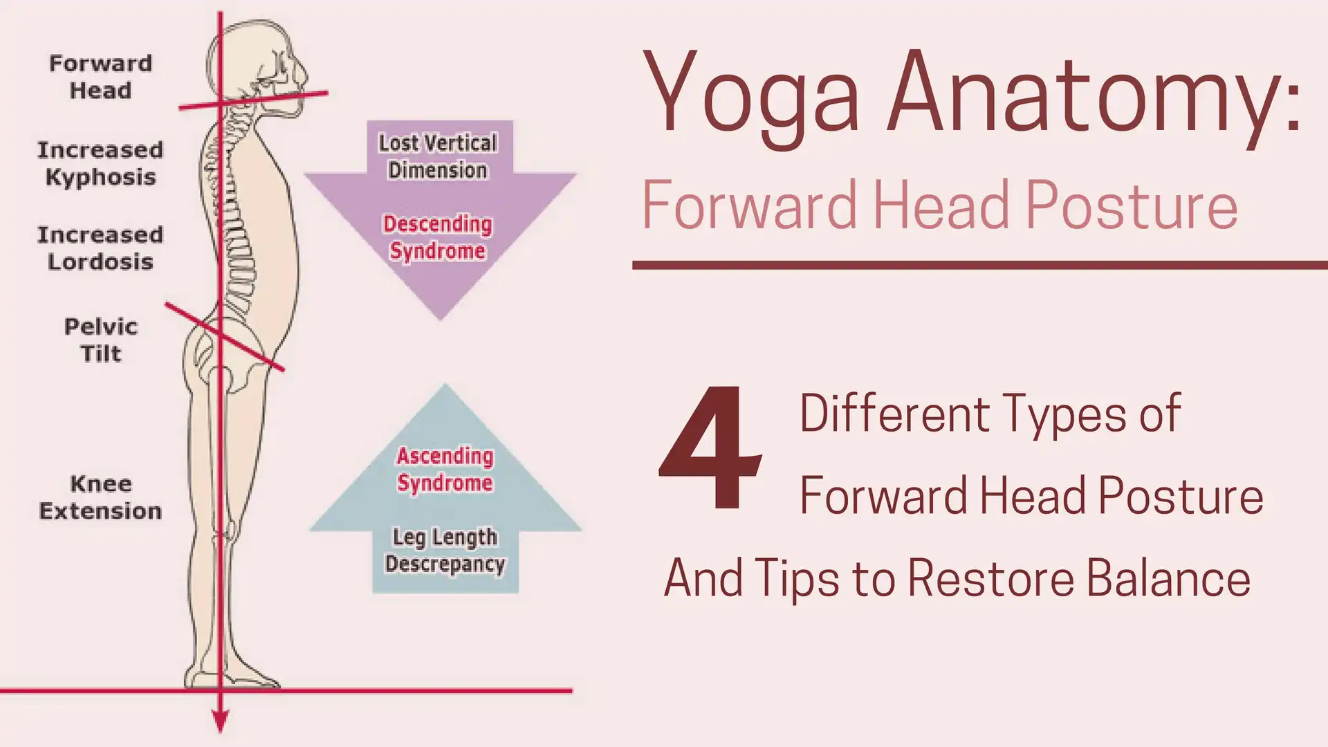 Yoga Anatomy: Different Types of Forward Head Posture and How to Work with  Them - YogaUOnline