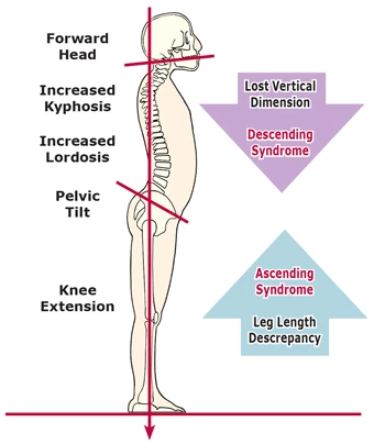 Characteristics of head and neck alignment and function of deep