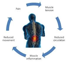 A chart showing the connection between muscle tension, reduced circulation, muscle inflammation, reduced movement, and pain