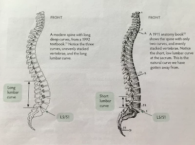 vertebrae, natural curve of the spine, poor curve of spine, spinefulness