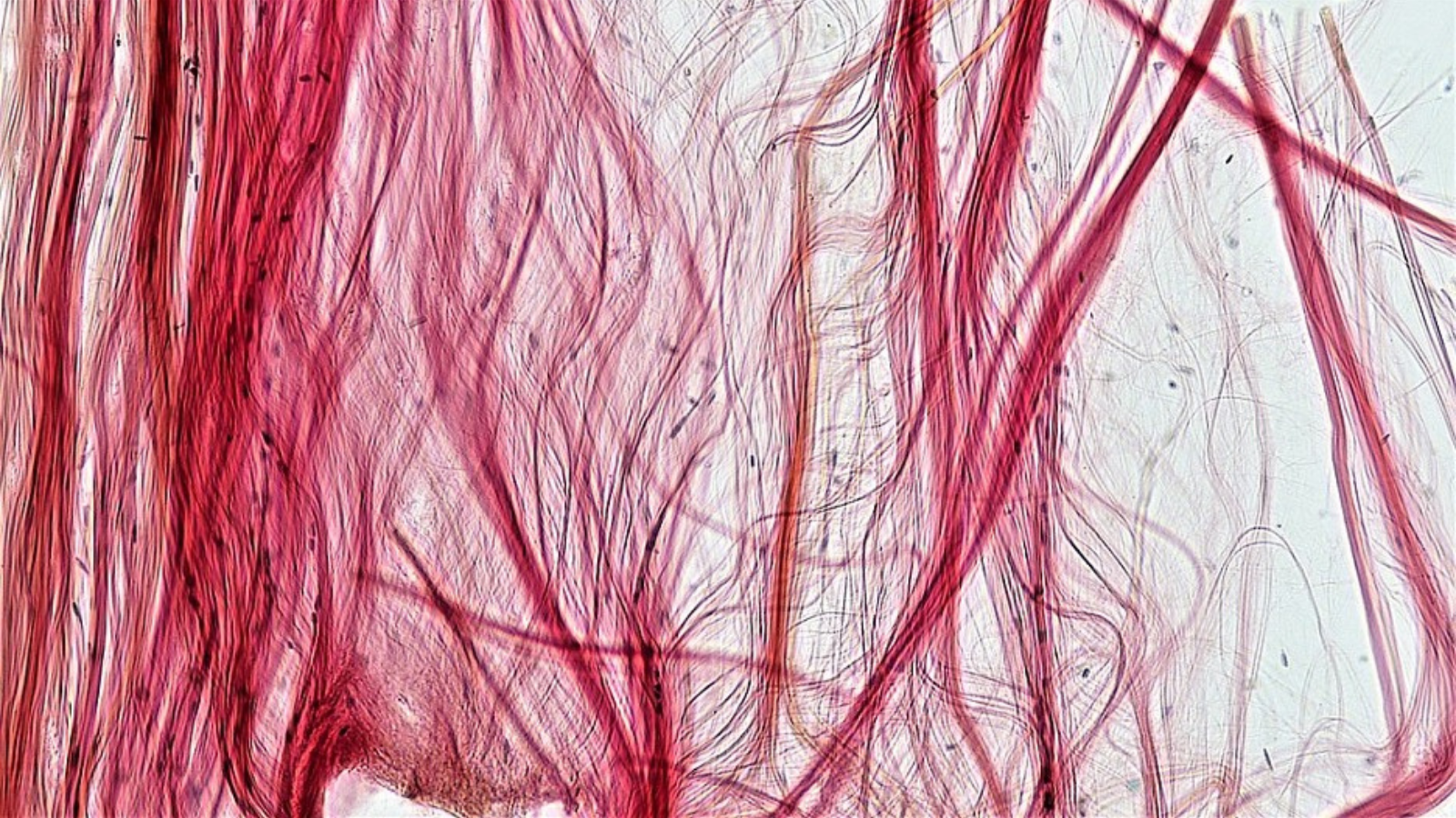 Connective Tissue Tendon, photo by Berkshire Bioscience Library 