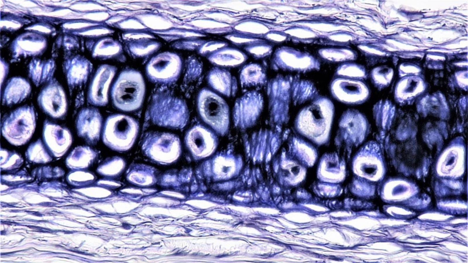 Connective Tissue Cartilage, photo by Berkshire Bioscience Library