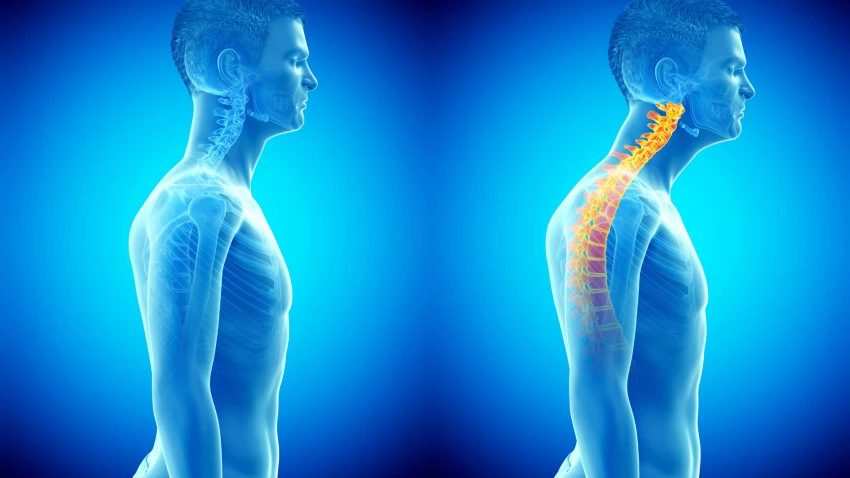 Do You Have Neck Tension? Here Are 3 Patterns that Can Cause Pain -  YogaUOnline