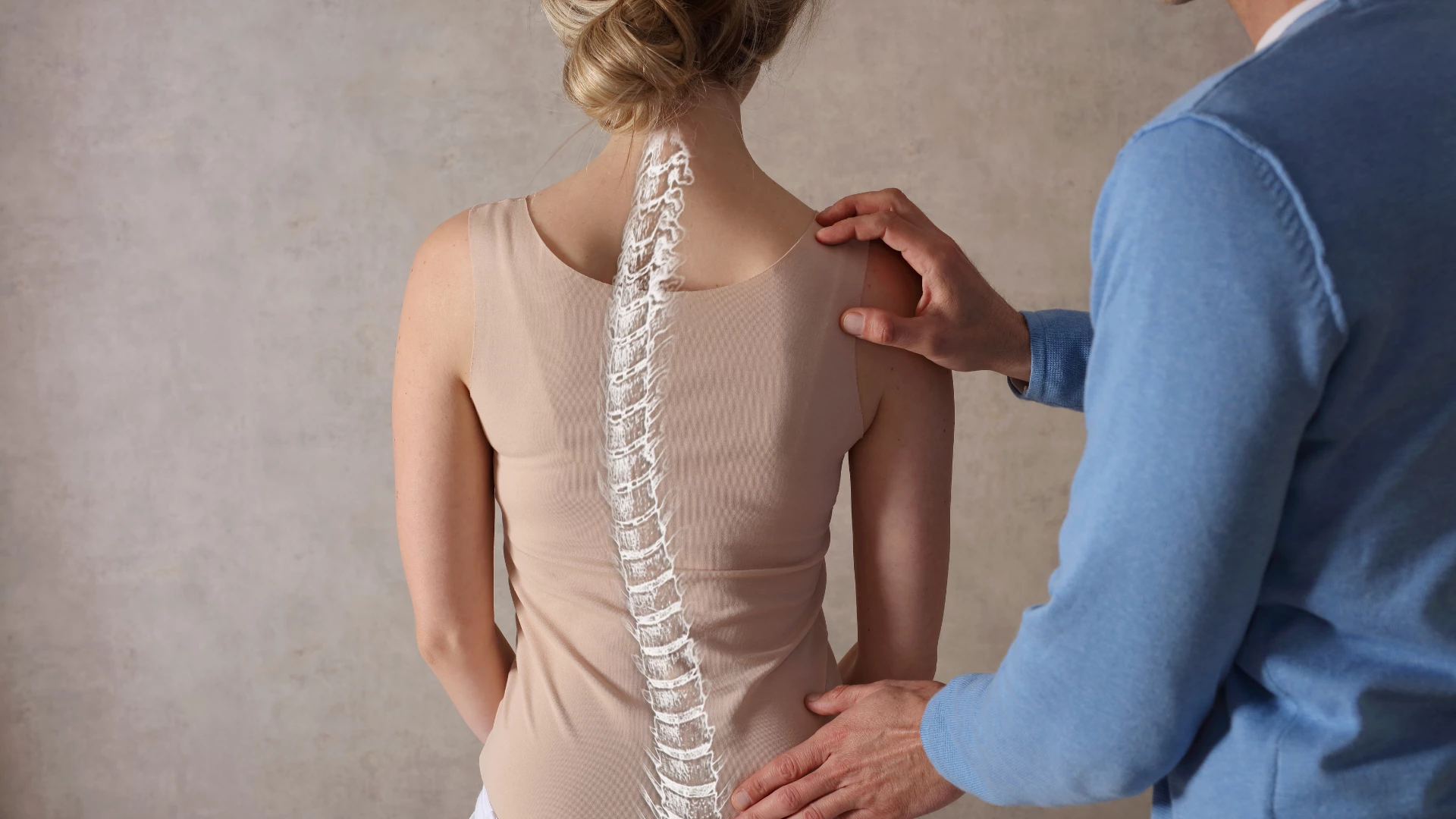 Scoliosis C Spine Curve Anatomy, Posture Correction. Back pain relief.