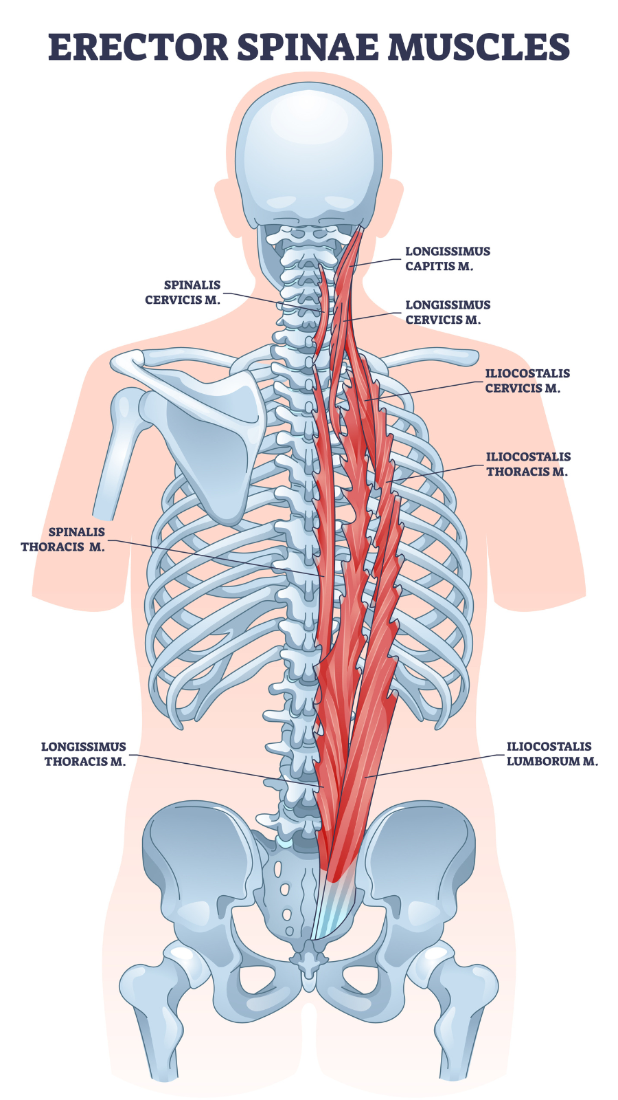 Erector spinae muscles with human back muscular system outline diagram. Labeled educational scheme with vertebrae lateral, column or medial parts division vector illustration.