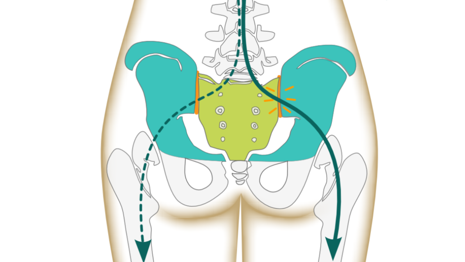 How your sacroiliac joint pain is turning into pelvic floor