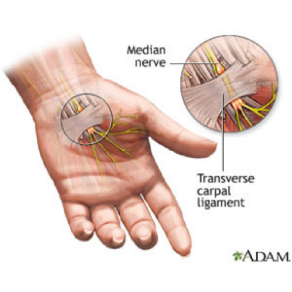 Image showing the carpal tunnel in your wrist.