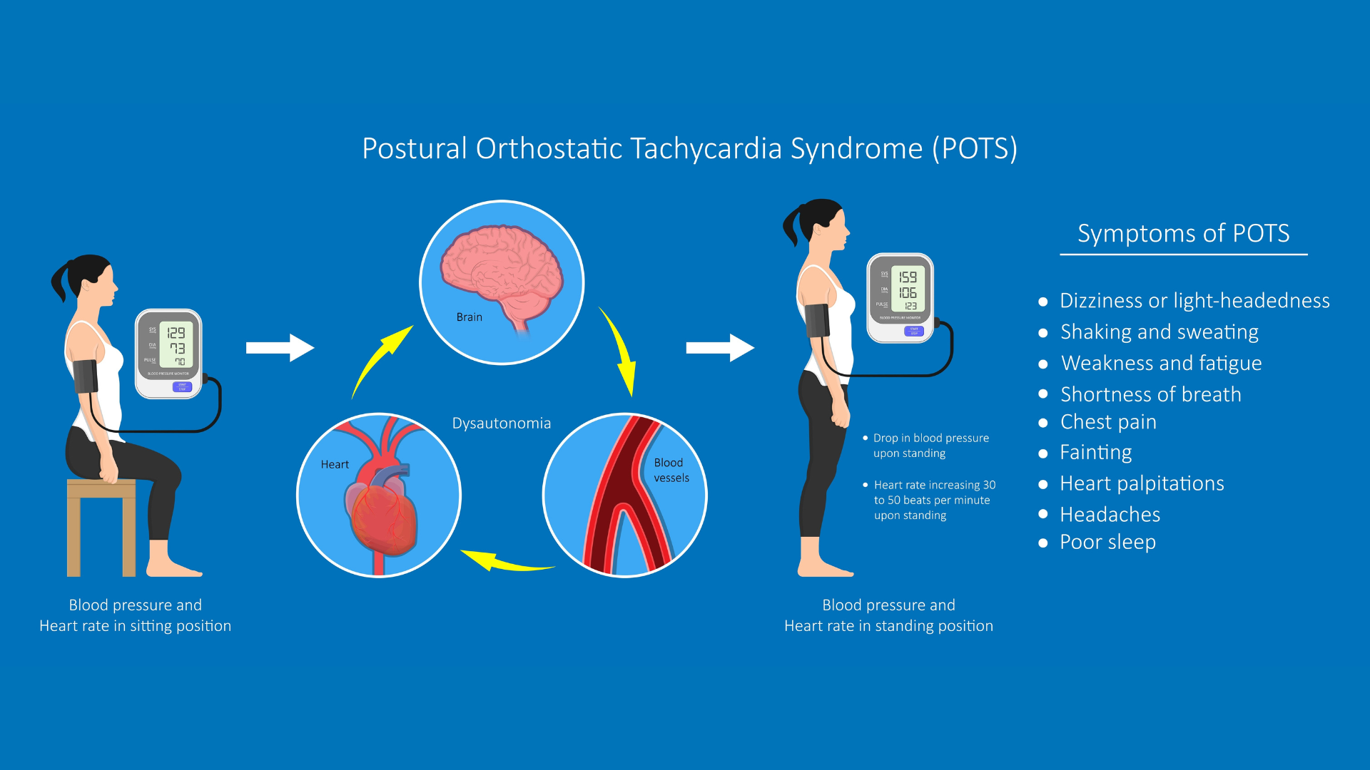 Illustration of the many health related symptoms of people suffering from Dysautonomia or POTS also known as Postural Orthostatic Tachycardia Syndrome