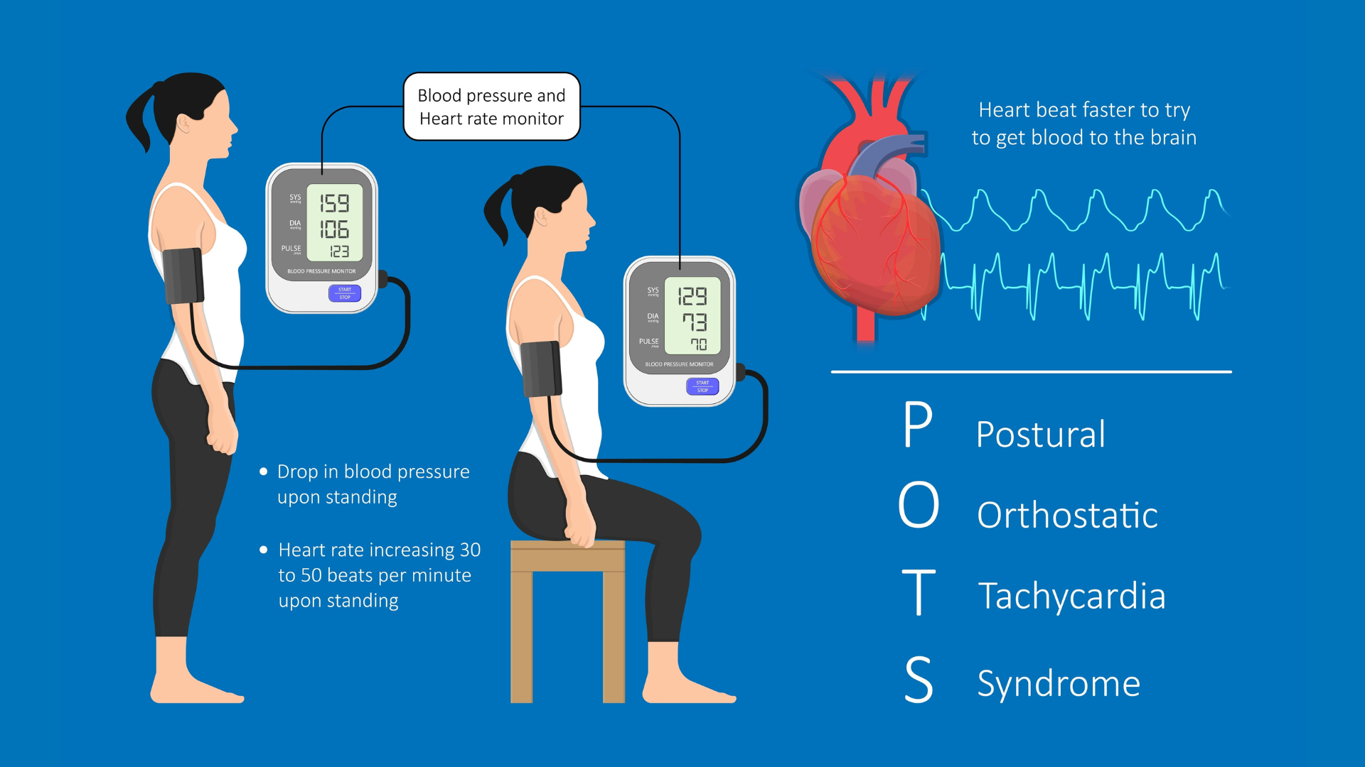 Illustration of the Blood pressure and heart rate issue that can occur with Dysautonomia or POTS also known as Postural Orthostatic Tachycardia Syndrome.