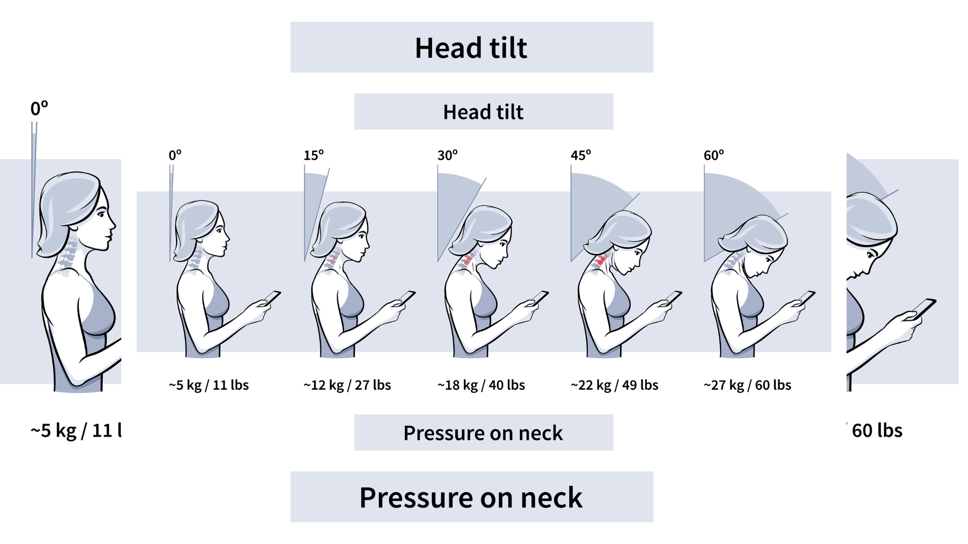 Text Neck Syndrome is Now a New Global Epidemic - YogaUOnline