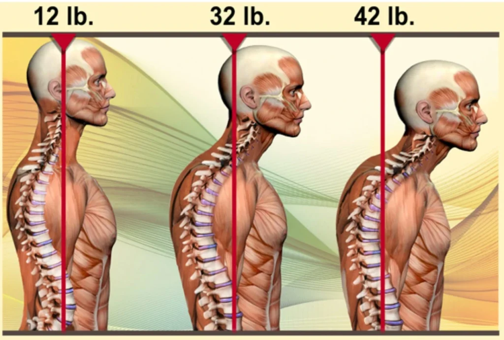 Beyond Bone Density: The Missing Elements in Fracture Prevention
